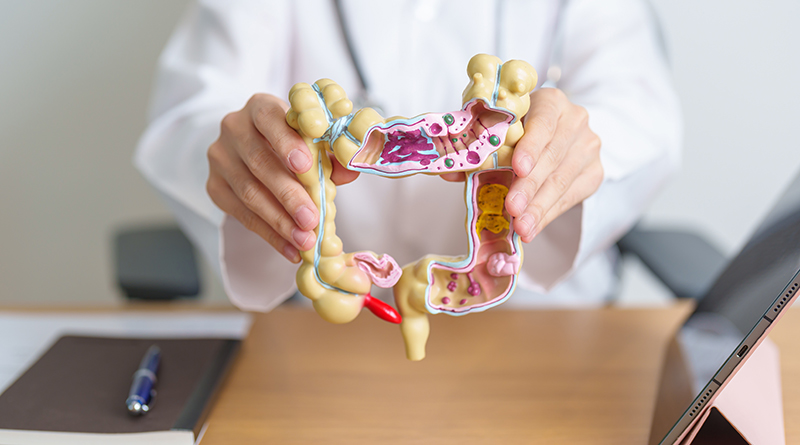 Rates Of Colorectal Cancer Rising In Younger People